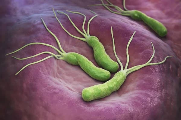 Microorganismo común provoca millones de casos de cáncer gástrico