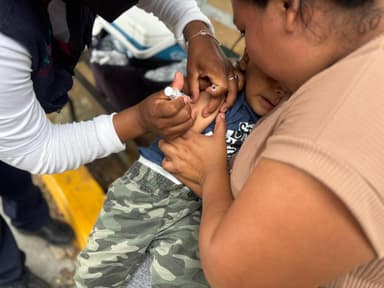 ImagenConfirman primer caso importado de sarampión en Chiapas