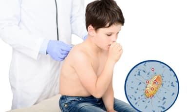 ImagenAlerta Salud de alza en casos de tosferina 