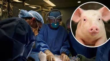 ImagenFallece hombre que recibió trasplante de riñón de cerdo