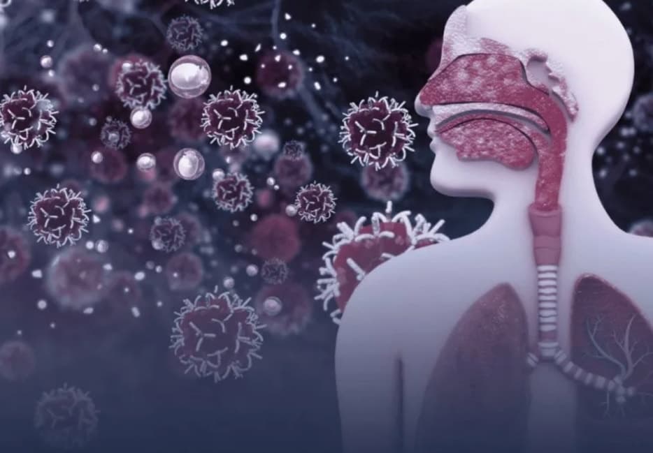 Confirman presuntos casos de Metapneumovirus en Campeche