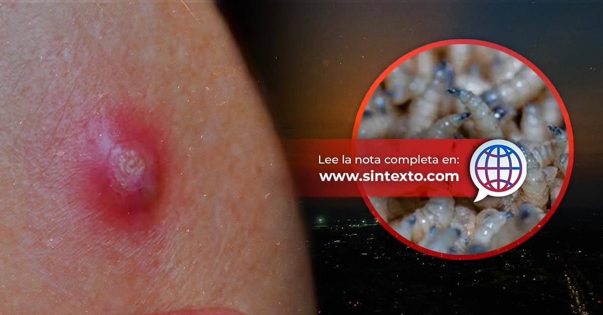 Repunta Gusano Barrenador en humanos en Tabasco