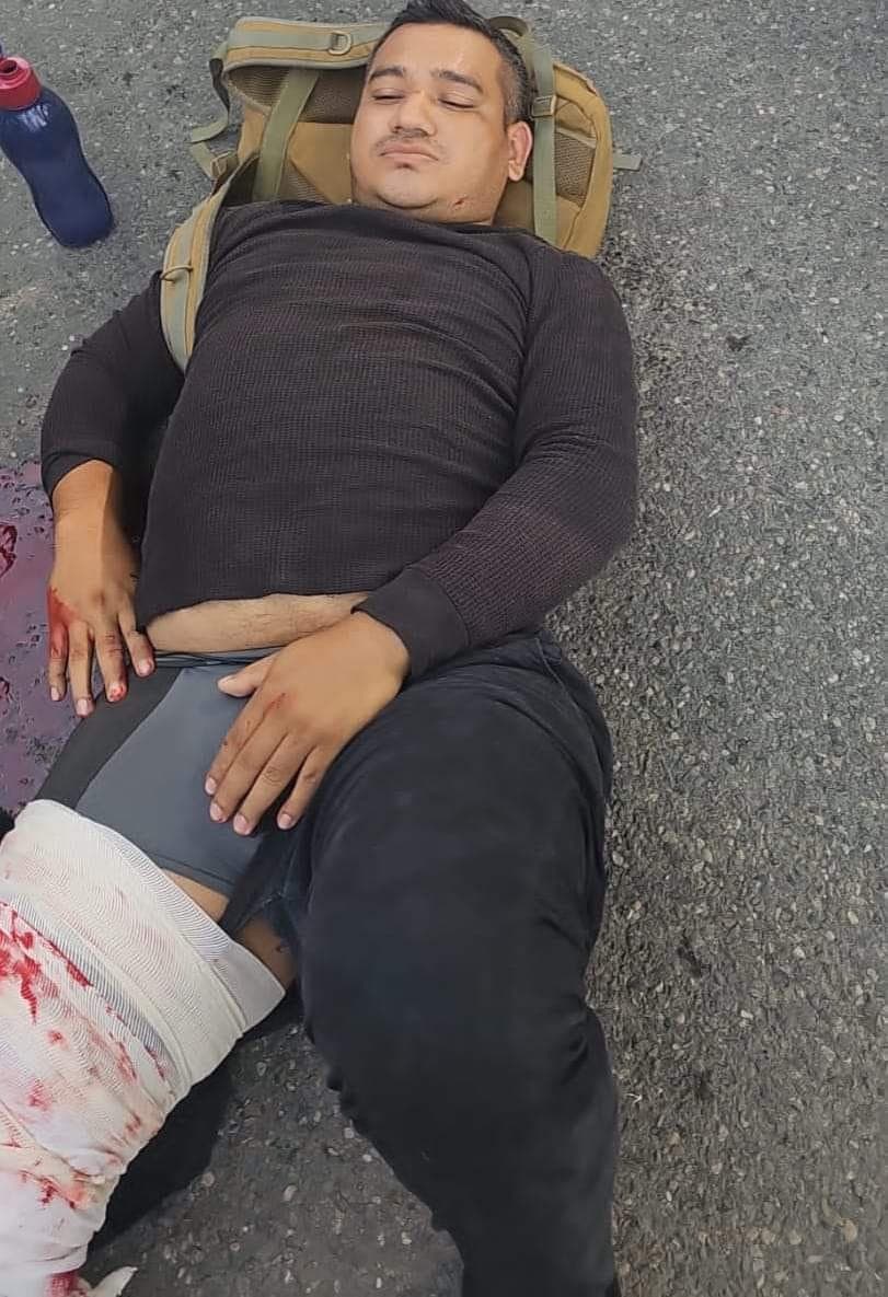 Lo balean y le roban moto 