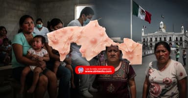 ImagenAcumula Tabasco 50 casos de Sarampión