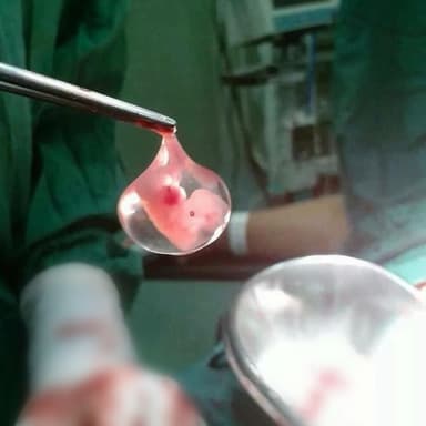 ImagenLegalización del aborto polariza a Tabasco