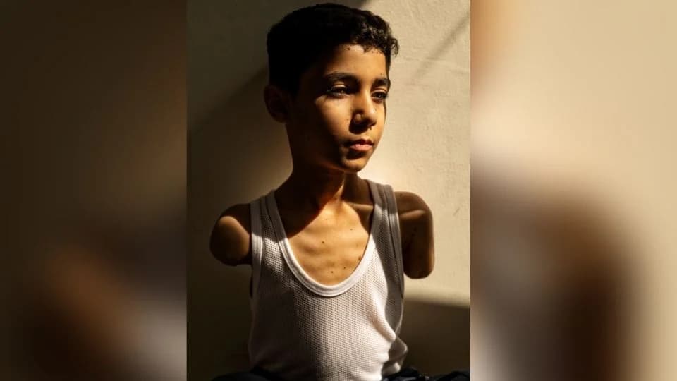 Gana como foto del año, retrato de niño amputado por un ataque israelí en Gaza