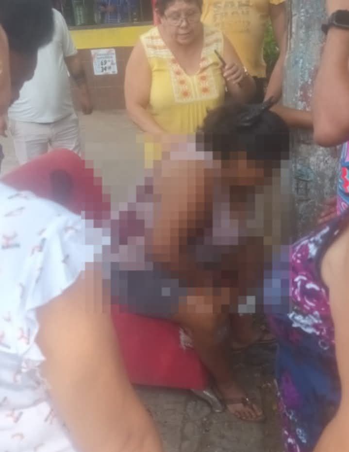 Acribillan a mujer por error