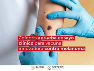 ImagenAprueban ensayo clínico para vacuna contra melanoma 