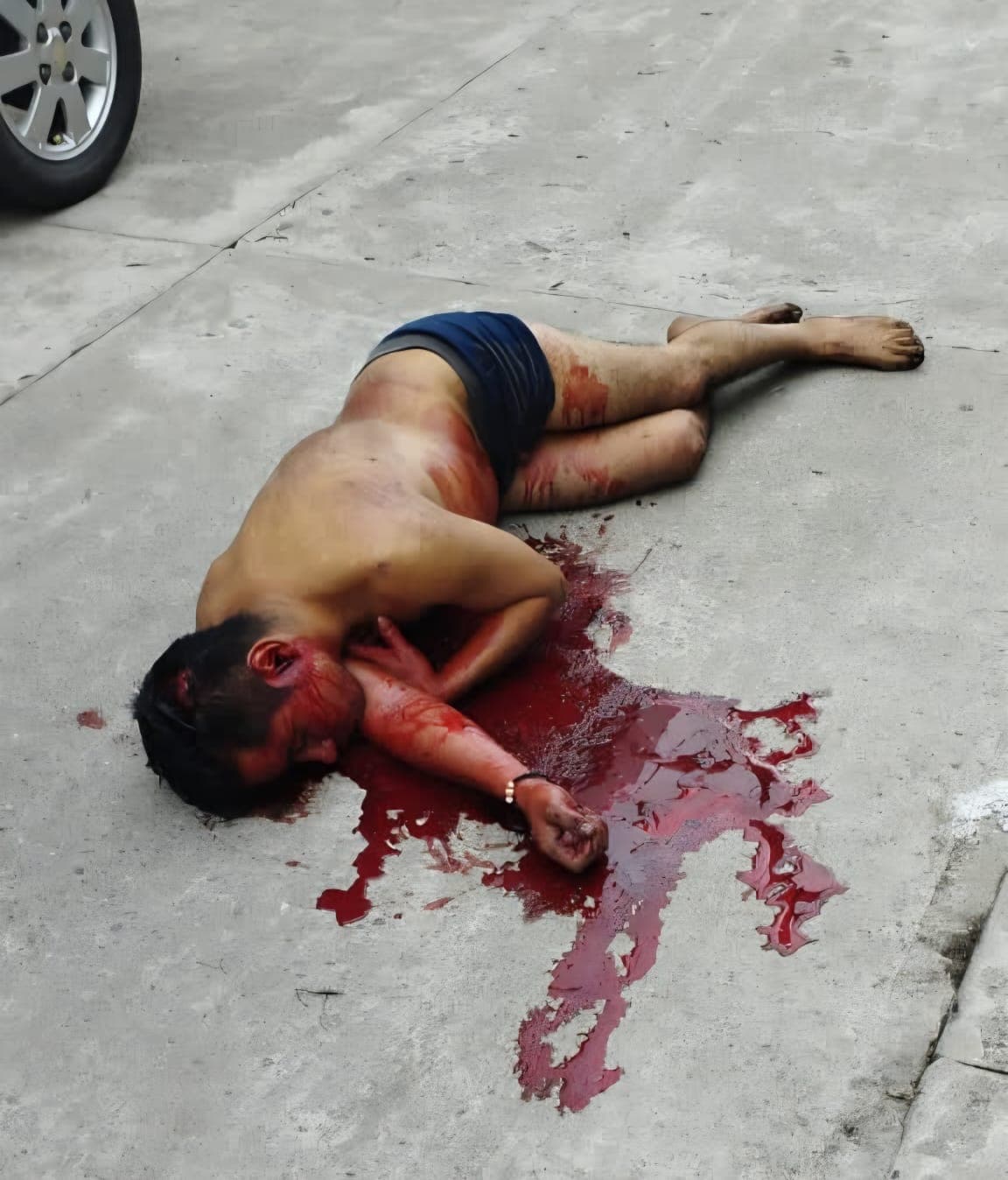 Cae de tercer piso en Cárdenas, fallece 
