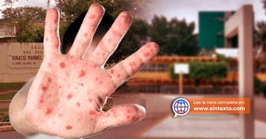 ImagenAlerta comunidad educativa de Tabasco por brote de Sarampión  