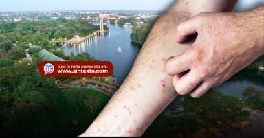 ImagenCalma pide May por Sarampión, asegura contención