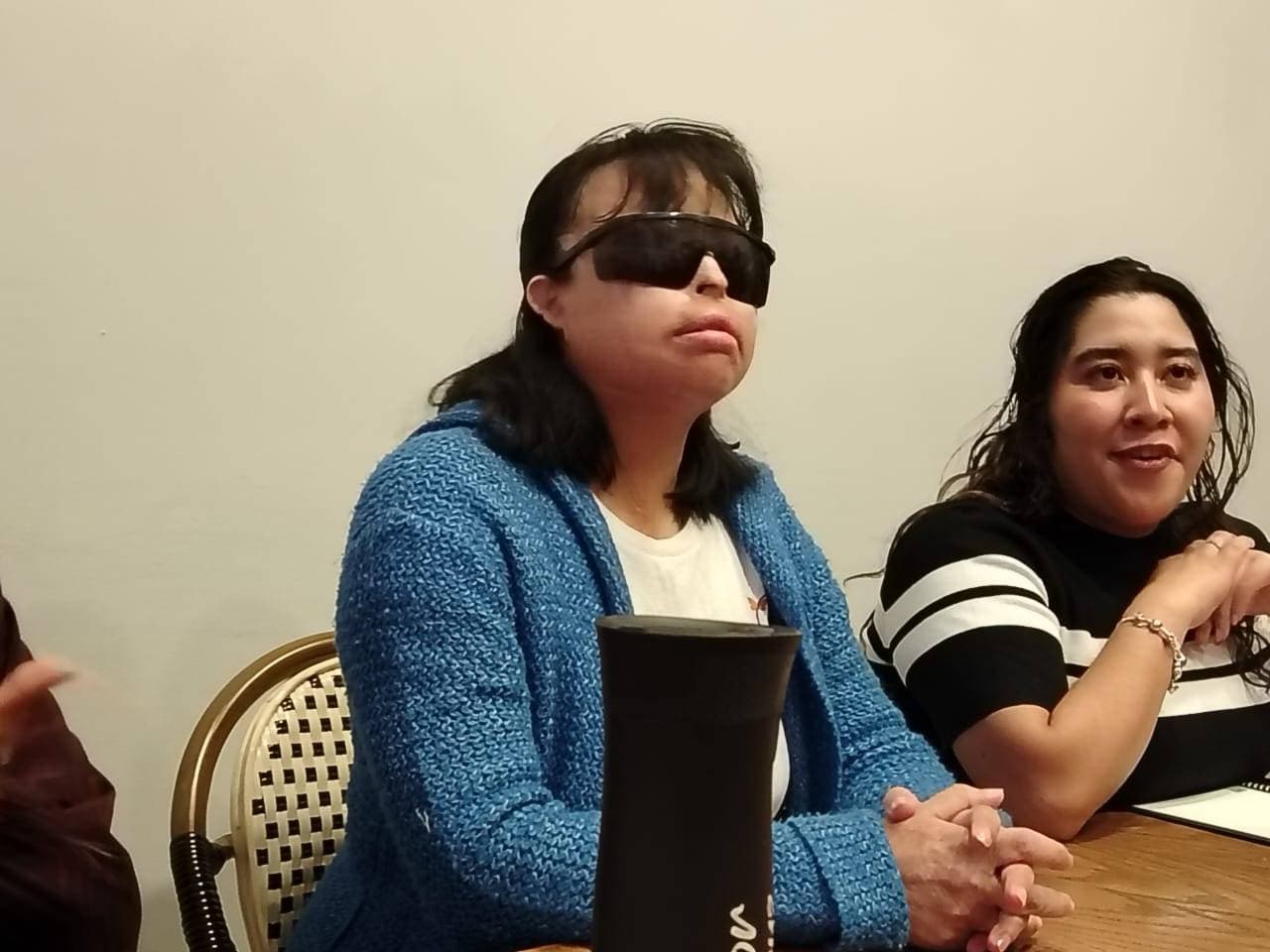 La atacaron con sosa cáustica, siguen impunes