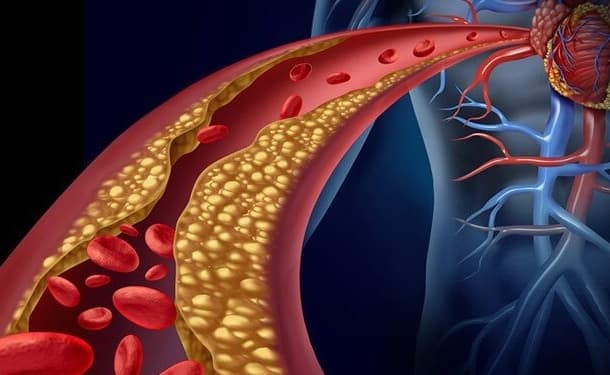 Exhorta IMSS a veracruzanos a mantener alimentación saludable