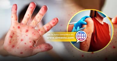 Imagen60% de contagiados de Sarampión en Tabasco viajaron a Chiapas 