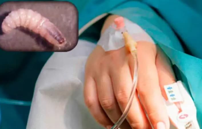 Confirman muerte de anciana por gusano barrenador en Campeche