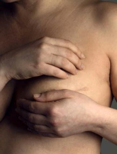 ImagenAfecta cáncer mamario a menores de 40 años 