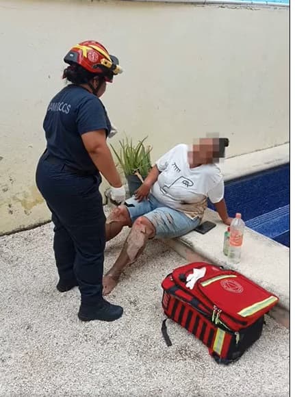 Mujer es atacada con gasolina por su pareja en Playa del Carmen