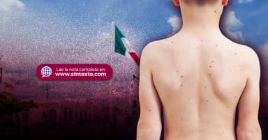 ImagenAdmite Salud sarampión al alza en Tabasco