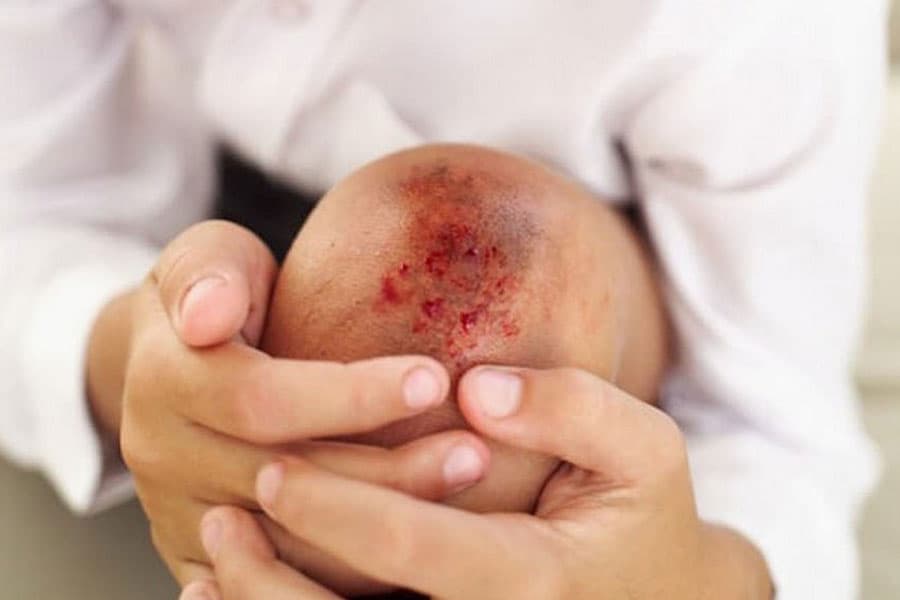 Chiapas sin insumos para tratar hemofilia