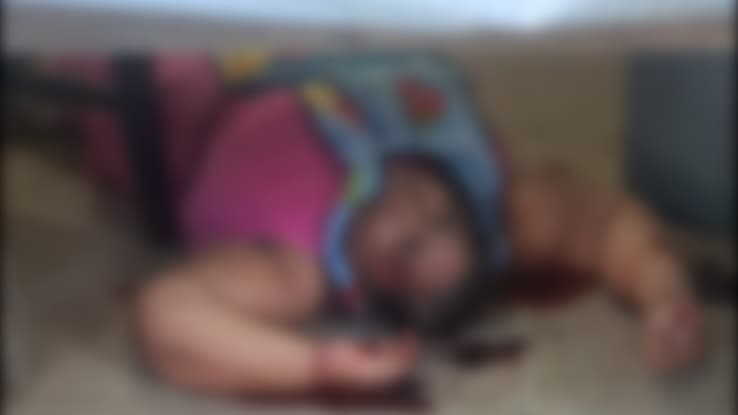 Agreden a balazos a mujer en Comalcalco