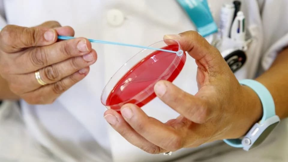 Encuentran indicios de sífilis en América antes de Colón