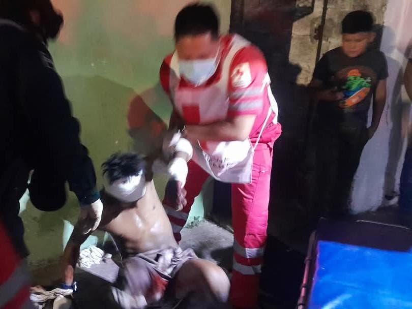 Agreden al "Guarumo" a machetazos en Cárdenas