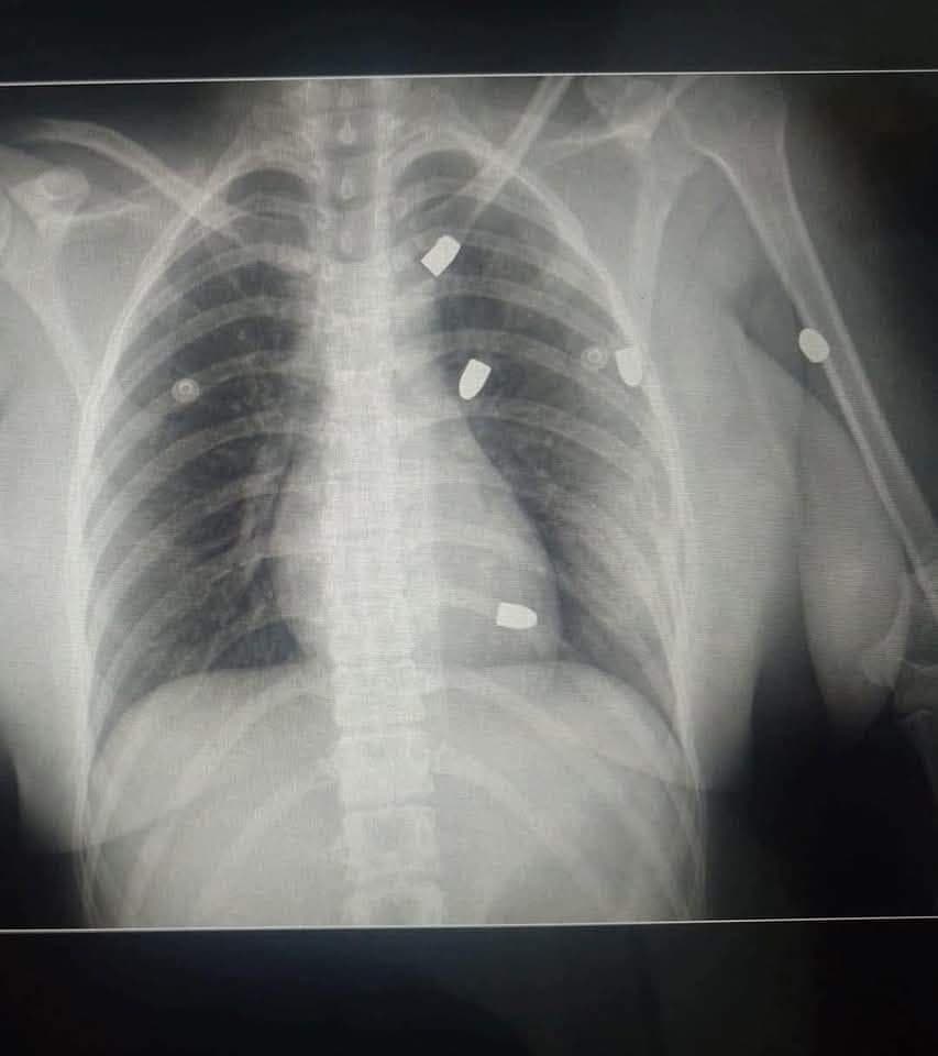 "Gracias a Dios estoy viva"