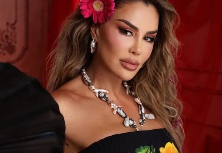 Operan a Ninel Conde antes de entrar a La Casa de los Famosos 2025