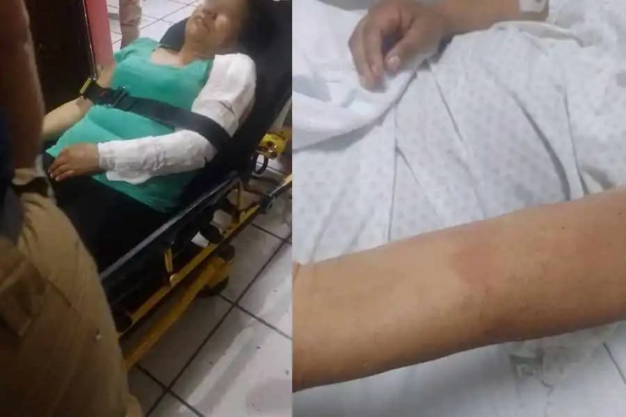 Sufre vendedora de antojitos agresión de clientes, le avientan recipiente con aceite hirviendo