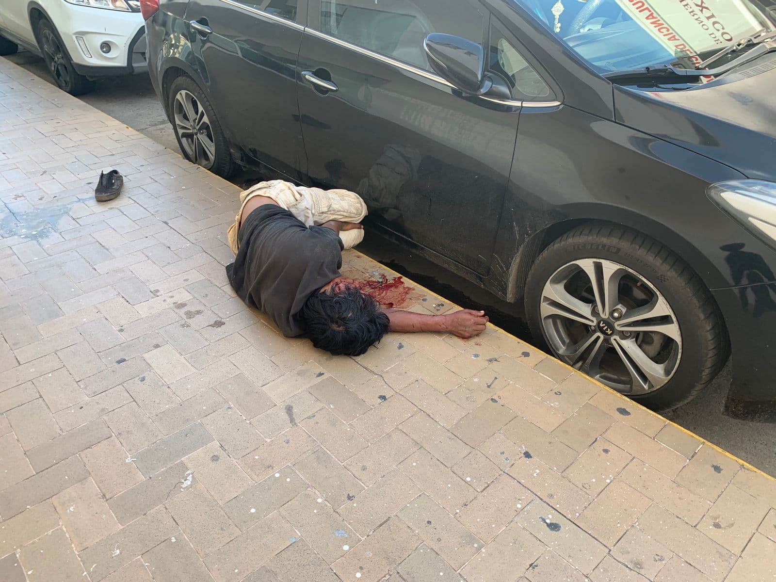 Desoye 911 llamado de auxilio e indigente se desangra